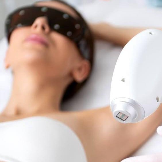 Epilazione laser